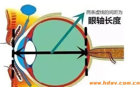 怎么看电视不伤眼?甚至还能延缓孩子近视?(图3) 文章配图-1
